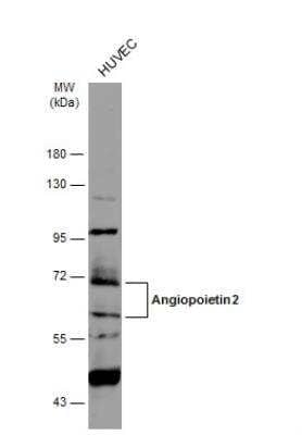 Western Blot: Angiopoietin-2 Antibody [NBP2-15386] - Whole cell extract (30 ug) was separated by 7.5% SDS-PAGE, and the membrane was blotted with Angiopoietin 2 antibody diluted at 1:3000. The HRP-conjugated anti-rabbit IgG antibody (NBP2-19301) was used to detect the primary antibody.