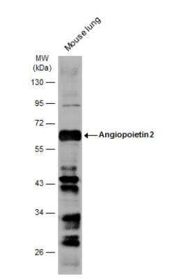 Western Blot: Angiopoietin-2 Antibody [NBP2-15386] - Mouse tissue extract (50 ug) was separated by 10% SDS-PAGE, and the membrane was blotted with Angiopoietin 2 antibody diluted at 1:1000. The HRP-conjugated anti-rabbit IgG antibody (NBP2-19301) was used to detect the primary antibody.