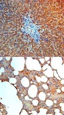 Immunohistochemistry: Angiopoietin-4 Antibody [NBP1-30090] -  Antibody to human angiopoietin4 on paraffin section of human liver (above), and of human lung (below)