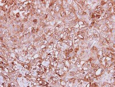 Immunohistochemistry-Paraffin: Angiopoietin-4 Antibody [NBP1-32607] - Paraffin-embedded DU145 xenograft, using antibody at 1:100 dilution.