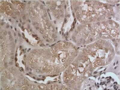 Immunohistochemistry-Paraffin: Angiopoietin-4 Antibody (RM0073-2H34) [NBP1-21700] - The Kidney tissue samples from the Folic Acid induced kidney injury model were fixed using 4% PFA at 4C for overnight and embeded in paraffin. 4um section was sublected to IHC with NBP1-21700