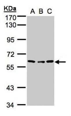 Western Blot: Angiopoietin-4 Antibody [NBP1-32607] - Sample (30ug whole cell lysate)A:H1299 B:Hep G2  C:MOLT4  7. 5% SDS PAGE, antibody diluted at 1:500.