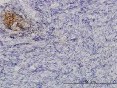 Immunohistochemistry-Paraffin: Angiopoietin-like Protein 1/ANGPTL1 Antibody (3A5) [H00009068-M03] - Immunoperoxidase of monoclonal antibody to ANGPTL1 ( Cat # H00009068-M03 ) on formalin-fixed paraffin-embedded human ovary. [antibody concentration 3 ug/ml]