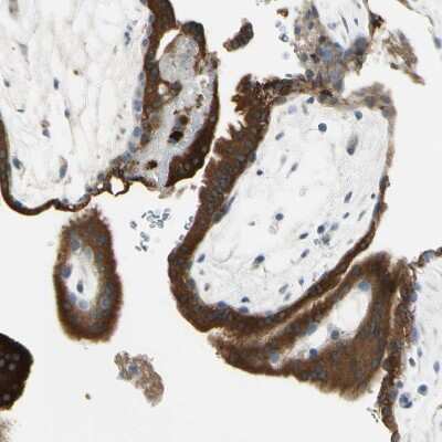 Immunohistochemistry-Paraffin: Angiopoietin-like Protein 1/ANGPTL1 Antibody [NBP1-89088] - Staining of human placenta shows strong cytoplasmic positivity in trophoblastic cells.