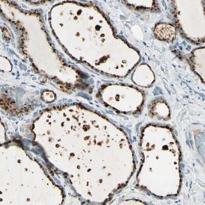 Immunohistochemistry-Paraffin: Angiopoietin-like Protein 1/ANGPTL1 Antibody [NBP1-89088] - Staining of human thyroid gland shows strong cytoplasmic positivity in glandular cells.