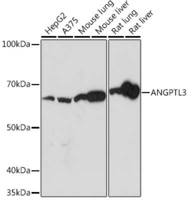 Western Blot: Angiopoietin-like Protein 3/ANGPTL3 Antibody (4W9A7) [NBP3-16596] - Western blot analysis of extracts of various cell lines, using Angiopoietin-like Protein 3/ANGPTL3 Rabbit mAb (NBP3-16596) at 1:1000 dilution. Secondary antibody: HRP Goat Anti-Rabbit IgG (H+L) at 1:10000 dilution. Lysates/proteins: 25ug per lane. Blocking buffer: 3% nonfat dry milk in TBST. Detection: ECL Basic Kit. Exposure time: 30s.