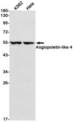 Western Blot: Angiopoietin-like Protein 4/ANGPTL4 Antibody (S04-1B5) [NBP3-14995] - Western blot detection of Angiopoietin-like Protein 4/ANGPTL4 in K562, Hela cell lysates using Angiopoietin-like Protein 4/ANGPTL4 Rabbit mAb (1:1000 diluted). Predicted band size: 45kDa. Observed band size: 55kDa.