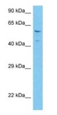 Western Blot: Angiopoietin-like Protein 6/ANGPTL6 Antibody [NBP3-10663] - Western blot analysis of Angiopoietin-like Protein 6/ANGPTL6 in Thymus Tumor. Antibody dilution at 1.0ug/ml