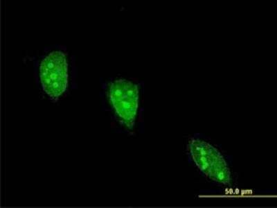 Immunocytochemistry/Immunofluorescence: Angiopoietin-like Protein 7/ANGPTL7 Antibody (2C6) [H00010218-M04-100ug] - Monoclonal antibody to ANGPTL7 on HeLa cell . [antibody concentration 10 ug/ml]