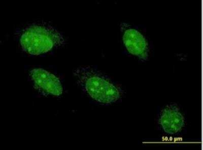 Immunocytochemistry/Immunofluorescence: Angiopoietin-like Protein 7/ANGPTL7 Antibody (3F1) [H00010218-M05-100ug] -  Monoclonal antibody to ANGPTL7 on HeLa cell . [antibody concentration 10 ug/ml]