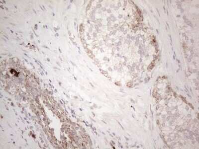 Immunohistochemistry: Angiopoietin-like protein 8/Betatrophin Antibody (OTI1B12) - Azide and BSA Free [NBP2-72046] - Analysis of Human prostate tissue. (Heat-induced epitope retrieval by 1mM EDTA in 10mM Tris buffer (pH8.5) at 120C for 3 min)