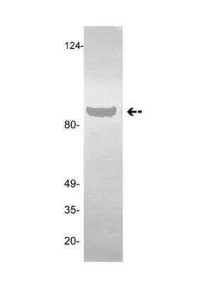 Western Blot: Angiostatin Antibody (GMA-013) [NBP2-29812] - 2ug of human plasminogen/angiostatin was probed with anti-Plasminogen/Angiostatin, clone GMA-013 (1ug/ml).  Arrow indicates plasminogen (~88kDa).