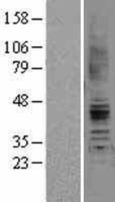 Western Blot: AGTR-2 Overexpression Lysate [NBL1-07397] -  Left-Empty vector transfected control cell lysate (HEK293 cell lysate); Right -Over-expression Lysate for Angiotensin II Type 2 Receptor.