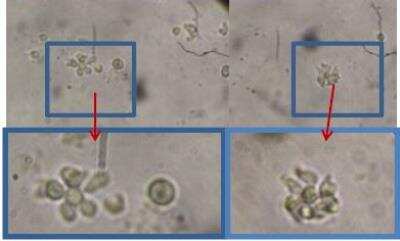 B Cell Stimulation: Animal Blood B Booster Kit [DDXK-AnBBB] - Microscopic observation of canine lymphocyte activation after the first stimulation.