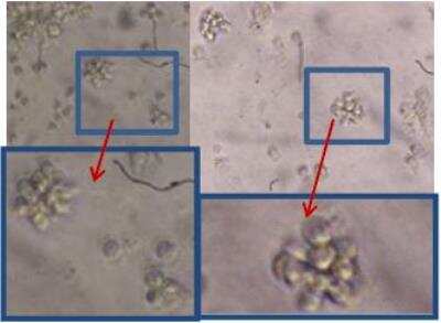 B Cell Stimulation: Animal Blood B Booster Kit [DDXK-AnBBB] - Microscopic observation of canine lymphocyte activation after 2nd stimulation.