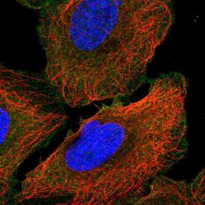 Immunocytochemistry/Immunofluorescence: Ankyrin 3 Antibody [NBP2-58275] - Staining of human cell line U-2 OS shows localization to plasma membrane.