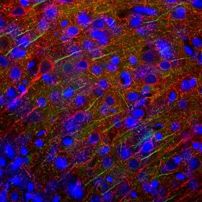 Immunocytochemistry/Immunofluorescence: Ankyrin 3 Antibody [NBP3-05528] - Immunofluorescent analysis of cortex section of rat brain stained with Ankyrin 3 Antibody at a at a dilution of of 1:2,000 in green and costained with rabbit polyclonal antibody to NF-L at a at a dilution of of 1:5,000 in red. The blue is Hoechst staining of nuclear DNA. Following transcardial perfusion of rat with 4% paraformaldehyde, brain was post fixed for 24 hours, cut to 45uM, and free-floating sections were stained with above antibodies. The Ankyrin 3 Antibody stains the axonal initial segments, while the NF-L antibody labels dendrites and axons of neuronal cells.