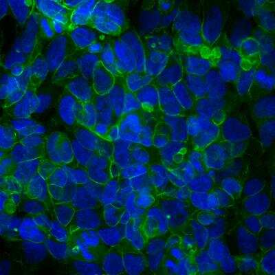 Immunocytochemistry/Immunofluorescence: Ankyrin 3 Antibody [NBP3-05528] - Immunofluorescent analysis of cortex section of rat brain stained with Ankyrin 3 Antibody at a at a dilution of of 1:2,000 in green and costained with rabbit polyclonal antibody to NF-L at a at a dilution of of 1:5,000 in red. The blue is Hoechst staining of nuclear DNA. Following transcardial perfusion of rat with 4% paraformaldehyde, brain was post fixed for 24 hours, cut to 45uM, and free-floating sections were stained with above antibodies. The Ankyrin 3 Antibody stains the axonal initial segments, while the NF-L antibody labels dendrites and axons of neuronal cells.