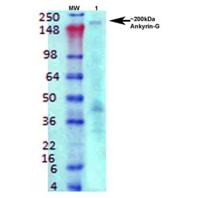 Western Blot: Ankyrin 3 Antibody (S106-20) [NBP2-59310] - Western Blot analysis of Rat brain membrane lysate showing detection of Ankyrin 3 protein using Mouse Anti-Ankyrin 3 Monoclonal Antibody, Clone S106-20 (NBP2-59310). Primary Antibody: Mouse Anti-Ankyrin 3 Monoclonal Antibody (NBP2-59310) at 1:1000.