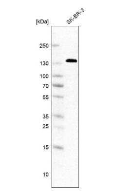 Western Blot: Ankyrin 3 Antibody [NBP2-58275] -  Analysis in human cell line SK-BR-3.