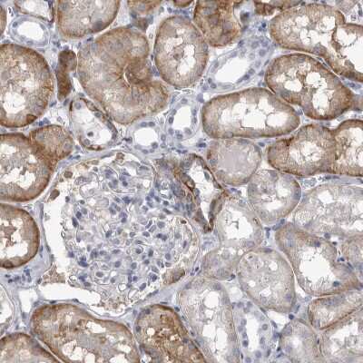 Immunohistochemistry-Paraffin: Ankyrin Brain Antibody [NBP2-33863] - Staining of human kidney shows weak to moderate cytoplasmic positivity in cells in tubules.