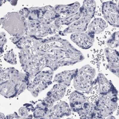 Immunohistochemistry-Paraffin: Ankyrin Brain Antibody [NBP2-33863] - Staining of human placenta shows no positivity in trophoblastic cells as expected.