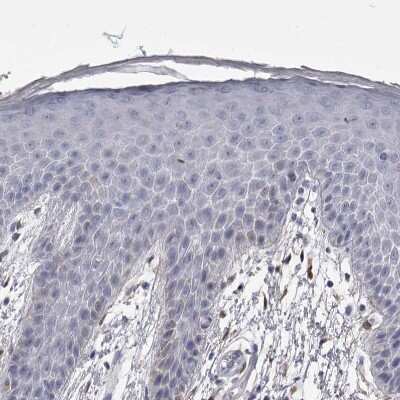 Immunohistochemistry-Paraffin: Ankyrin Brain Antibody [NBP2-33863] - Staining of human skin shows no positivity in squamous epithelial cells as expected.