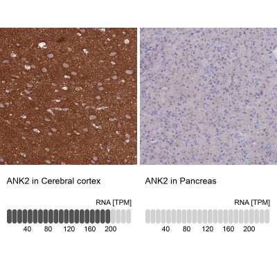 <b>Orthogonal Strategies Validation. </b>Immunohistochemistry-Paraffin: Ankyrin Brain Antibody [NBP2-34023] - Staining in human cerebral cortex and pancreas tissues using anti-ANK2 antibody. Corresponding ANK2 RNA-seq data are presented for the same tissues.