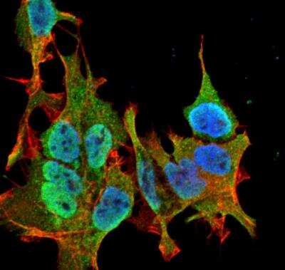 Immunocytochemistry/Immunofluorescence: Ankyrin Brain Antibody (S105-13) [NBP2-59374] - Tissue: Neuroblastoma cell line SK-N-BE. Species: Human. Fixation: 4% Formaldehyde for 15 min at RT. Primary Antibody: Mouse Anti-Ankyrin B Monoclonal Antibody at 1:100 for 60 min at RT. Secondary Antibody: Goat Anti-Mouse ATTO 488 at 1:100 for 60 min at RT. Counterstain: Phalloidin Texas Red F-Actin stain; DAPI (blue) nuclear stain at 1:1000; 1:5000 for 60 min RT, 5 min RT. Localization: Cytoplasm