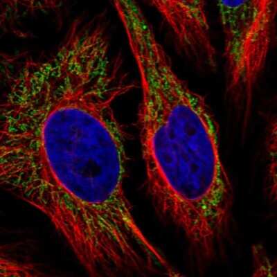 Immunocytochemistry/Immunofluorescence: Ankyrin Repeat Domain 33B Antibody [NBP2-30975] - Staining of human cell line HeLa shows localization to mitochondria.