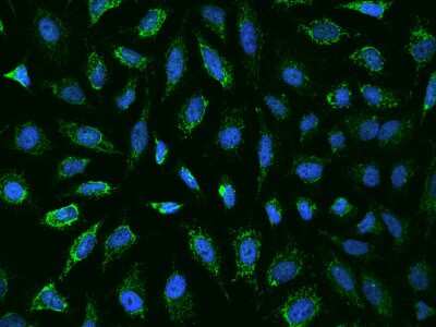 Immunocytochemistry/ Immunofluorescence Ankyrin Repeat Domain 33B Antibody - BSA Free
