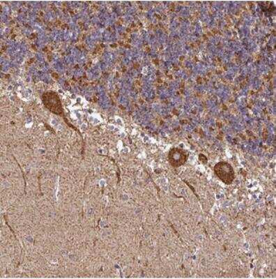 Immunohistochemistry-Paraffin: Ankyrin Repeat Domain 33B Antibody [NBP2-30975] - Staining of human cerebellum shows strong cytoplasmic positivity in Purkinje cells.