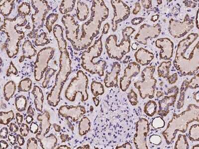 Immunohistochemistry-Paraffin: Ankyrin Repeat Domain 33B Antibody [NBP2-98013] - Immunochemical staining of human Ankyrin Repeat Domain 33B in human liver with rabbit polyclonal antibody at 1:100 dilution, formalin-fixed paraffin embedded sections.
