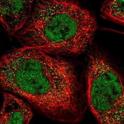 Immunocytochemistry/Immunofluorescence: Ankyrin repeat domain 39 Antibody [NBP1-91673] - Staining of human cell line A-431 shows positivity in nucleus but not nucleoli and cytoplasm.
