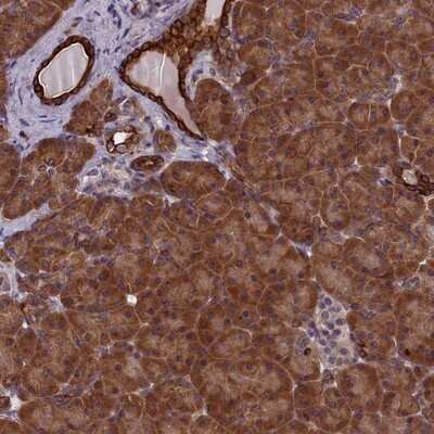 Immunohistochemistry-Paraffin: Ankyrin repeat domain 39 Antibody [NBP1-91673] - Staining of human pancreas shows strong cytoplasmic positivity in exocrine glandular cells.