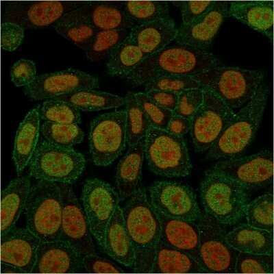 Immunocytochemistry/Immunofluorescence: Annexin A1 Antibody (ANXA1/3566) [NBP3-08708] - Immunofluorescence staining of paraformaldehyde-fixed HeLa cells with Annexin A1 Mouse Monoclonal Antibody (ANXA1/3566) followed by goat anti- Mouse IgG-CF488 (Green). Nuclei are labeled with RedDot (Red).