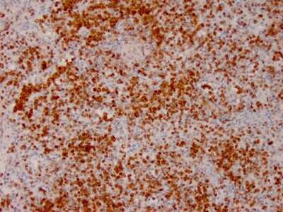 Immunohistochemistry-Paraffin: Annexin A1 Antibody (ANXA1/3566) [NBP3-07716] - Formalin-fixed, paraffin-embedded human Lymph Node stained with Annexin A1 Mouse Monoclonal Antibody (ANXA1/3566).