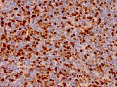 Immunohistochemistry-Paraffin: Annexin A1 Antibody (ANXA1/3566) [NBP3-07716] - Formalin-fixed, paraffin-embedded human Lymph Node stained with Annexin A1 Mouse Monoclonal Antibody (ANXA1/3566).