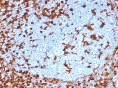 Immunohistochemistry-Paraffin: Annexin A1 Antibody (ANXA1/3869R) - Azide and BSA Free [NBP3-08709] - Formalin-fixed, paraffin-embedded human tonsil stained with Annexin A1 Recombinant Rabbit Monoclonal Antibody (ANXA1/3869R).