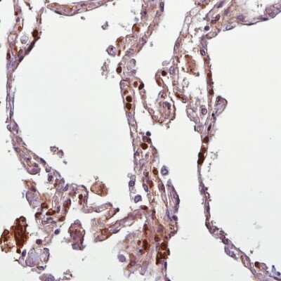 Immunohistochemistry-Paraffin: Annexin A1 Antibody (CL0199) [NBP2-52875] - Staining of human lung shows nuclear positivity in a subset of pneumocytes and lymphoid cells.