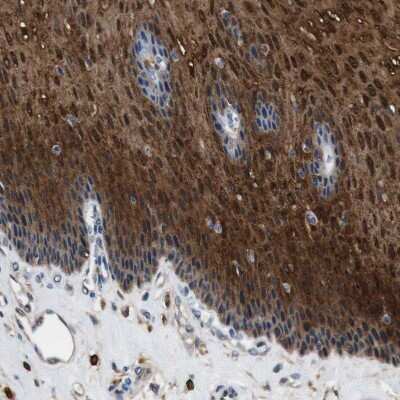 Immunohistochemistry-Paraffin: Annexin A1 Antibody [NBP1-90161] - Staining of human esophagus shows  strong positivity in squamous epithelial cells.