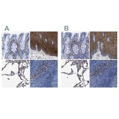 <b>Independent Antibodies Validation and Orthogonal Strategies Validation.</b>Immunohistochemistry-Paraffin: Annexin A1 Antibody [NBP1-90161] - Staining of human colon, esophagus, lung and lymph node using Anti-Annexin A1 antibody NBP1-90161 (A) shows similar protein distribution across tissues to independent antibody NBP1-90162 (B).