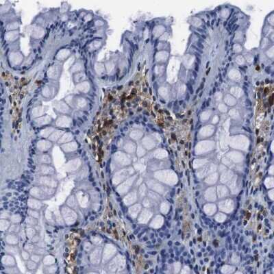 Immunohistochemistry-Paraffin: Annexin A1 Antibody [NBP1-90162] - Staining of human colon shows moderate positivity in lymphoid cells.