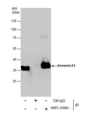 Immunoprecipitation: Annexin A1 Antibody [NBP1-33684] - Immunoprecipitation of Annexin A1 protein from HeLa whole cell extracts using 5 ug of Annexin A1 antibody. Western blot analysis was performed using Annexin A1 antibody. EasyBlot anti-Rabbit IgG was used as a secondary reagent.