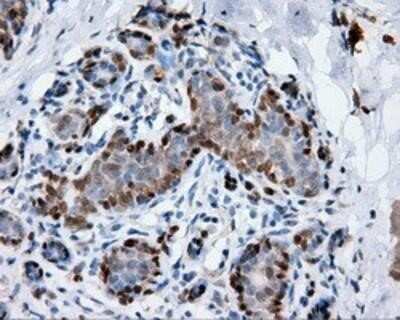 Immunohistochemistry: Annexin A1 Antibody (OTI3A8) - Azide and BSA Free [NBP2-70174] - Staining of paraffin-embedded breast tissue using anti-Annexin A1 mouse monoclonal antibody.