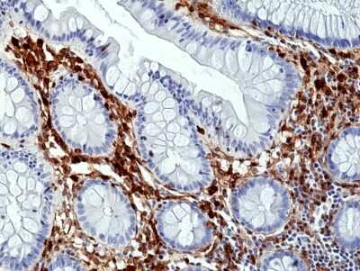 Immunohistochemistry-Paraffin: Annexin A1 Antibody (RM424) [NBP3-09177] - Immunohistochemical staining of formalin fixed and paraffin embedded human colon tissue section using NBP3-09176 at a 1:100 dilution.