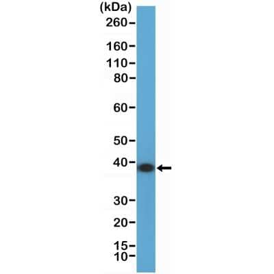 Western Blot: Annexin A1 Antibody (RM424) [NBP3-09177] - Western Blot of K562 cell lysate using NBP3-09117 at a 1:2000 dilution.