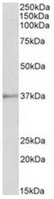 Western Blot: Annexin A1 Antibody [NBP1-18842] - Analysis of Pig Spleen lysate (35ug protein in RIPA buffer). 