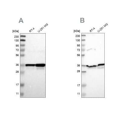 <b>Independent Antibodies Validation. </b>Western Blot: Annexin A1 Antibody [NBP1-90161] - Analysis using Anti-ANXA1 antibody NBP1-90161 (A) shows similar pattern to independent antibody NBP1-90162 (B).