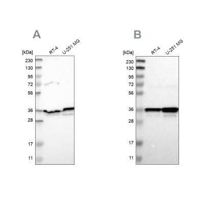 <b>Independent Antibodies Validation. </b>Western Blot: Annexin A1 Antibody [NBP1-90162] - Analysis using Anti-ANXA1 antibody NBP1-90162 (A) shows similar pattern to independent antibody NBP1-90161 (B).